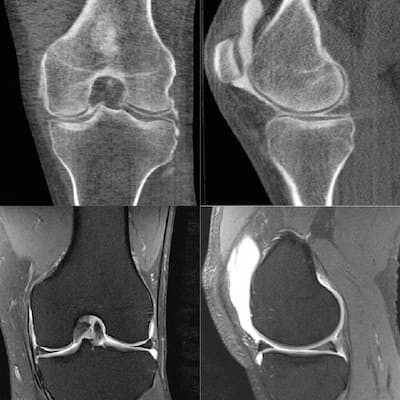 Рентген снимки коленного и тазобедренного суставов